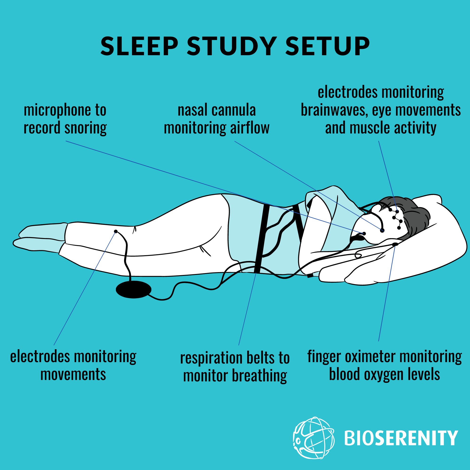 sleep-study-polysomnogram-what-to-expect-53-off