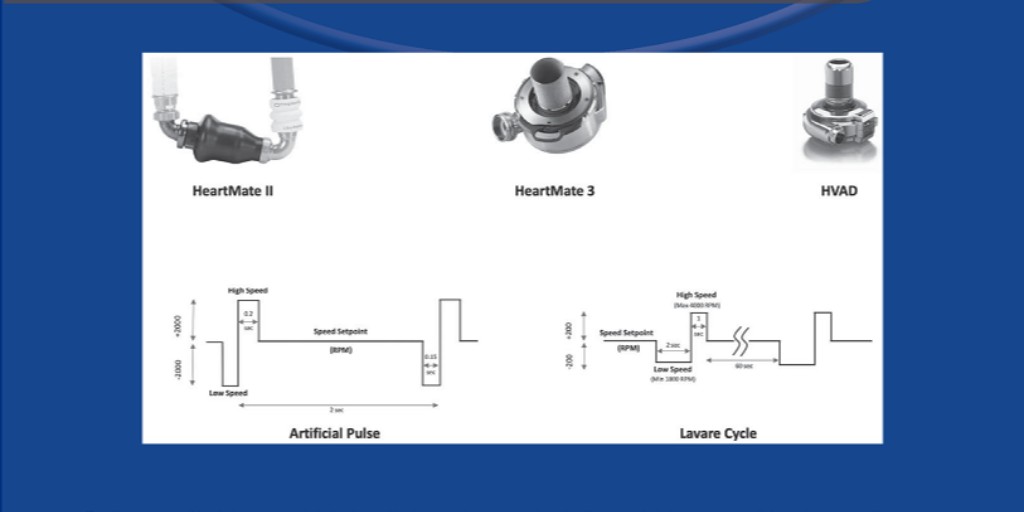 asaiojournal's tweet photo. The July issue is online! https://t.co/RHad5XBTtS
Several #FREE #OA #OpenAccess articles!
#LVAD #ECMO #COVID19 #HeartTx #TissueEngineering #LavareCycle #Pulsatility #MechanicalHeartValve #PedsVAD #PedsECMO #Pedscards #PedsICU #ECLS #Dialysis #Hypertension #ARDS #RVAD #LungTx https://t.co/caSKEoqmq1