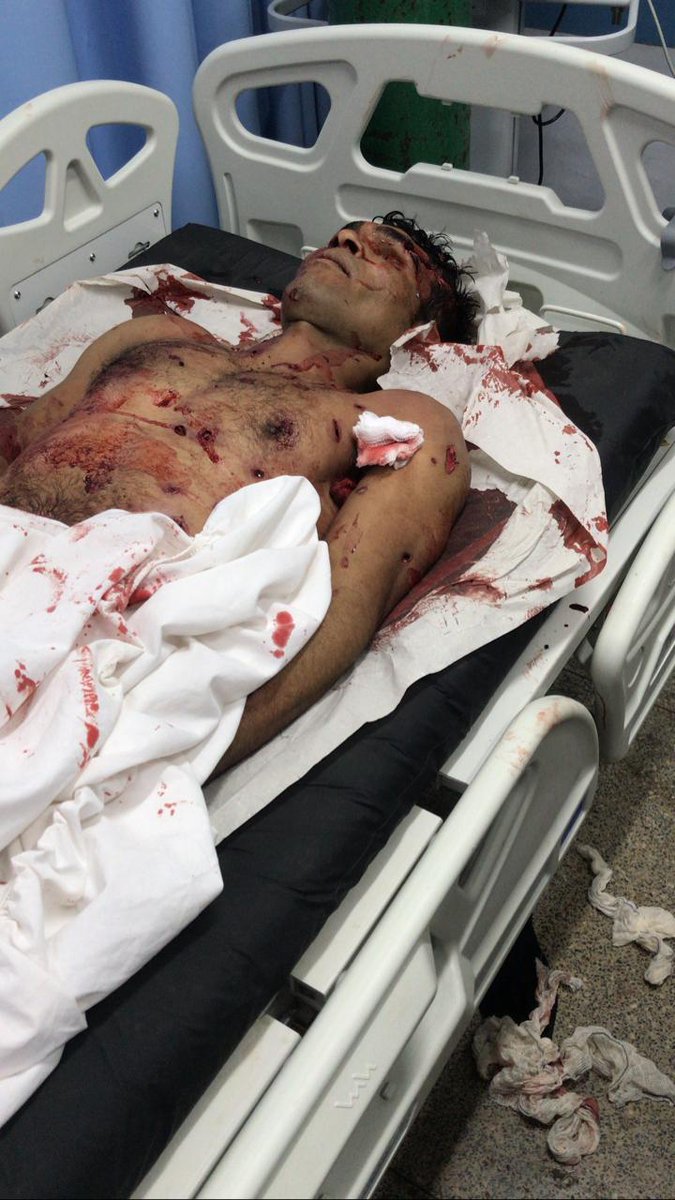 Elionilson (@elionilson5) on Twitter photo 