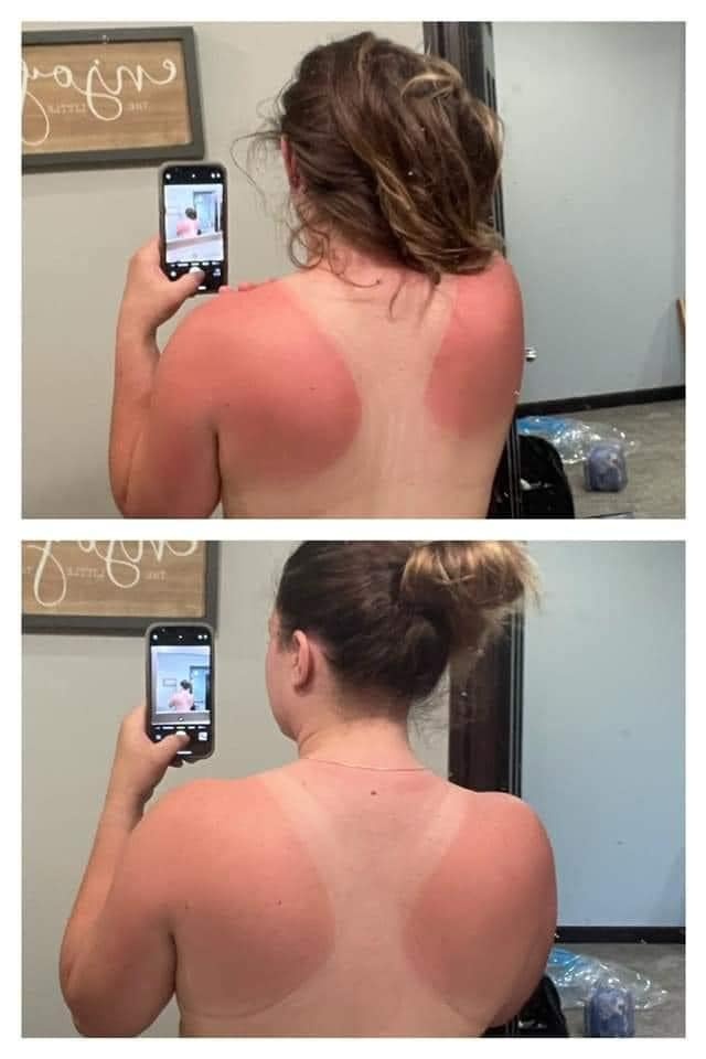 'Mama got a little bit of sun yesterday….WHOOPS! Thankful I had my toner and dream cream handy!! This is one use before bed around 9pm and then this morning around 6am!! 🤩🔥' -- Courtney
#sunburnrelief #summeressentials #aftersunlotion #aftersun #tomuchsun