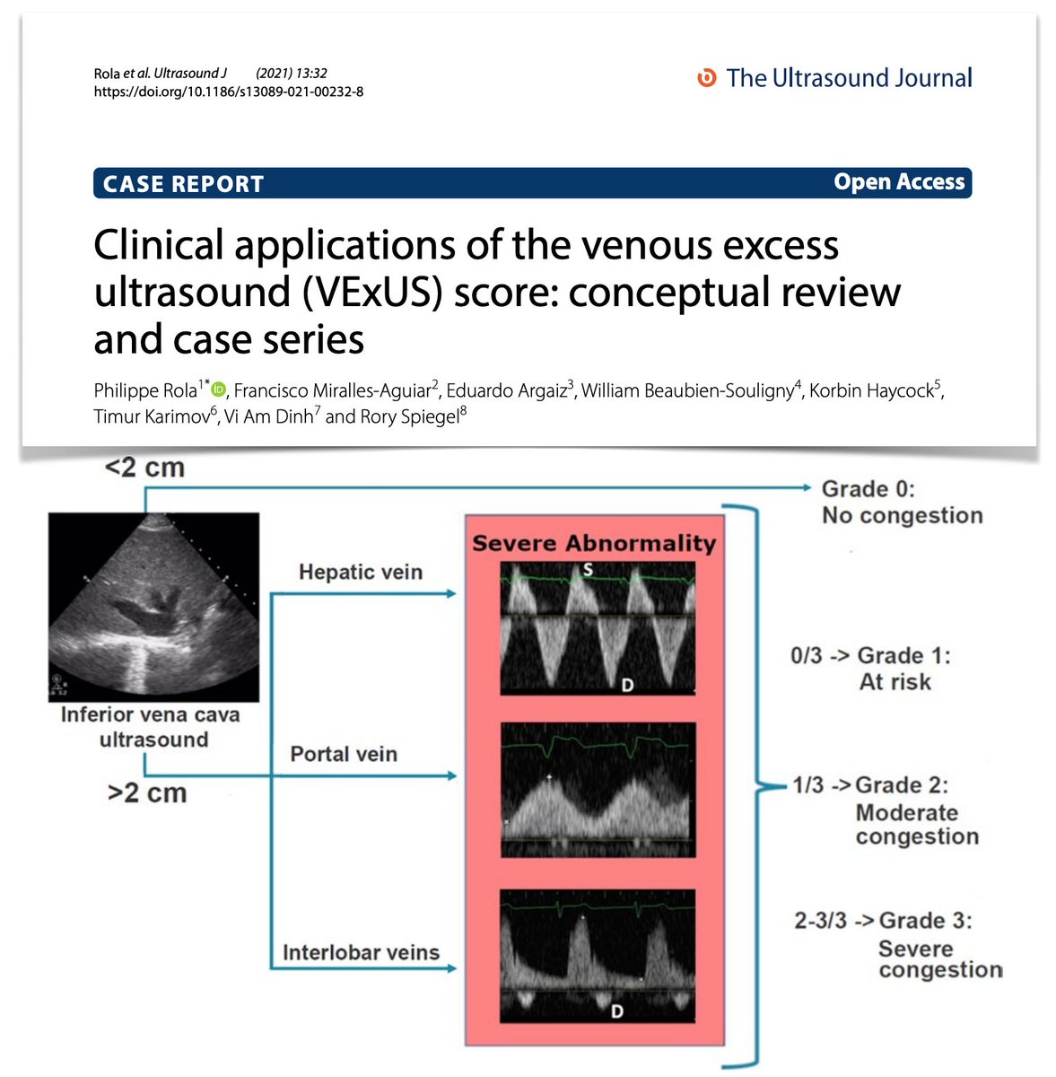 FOAMecmo's tweet photo. Venous Excess UltraSound?? window on venous (congestion) pathophysiology, which might guide precise fluid management! Here conceptual review + case series focused on #VExUS grading system: pathological basis, pitfalls, limitations #FOAMus #echofirst #POCUS
https://t.co/s5OC8cwSyu https://t.co/QIwhiUNCsn