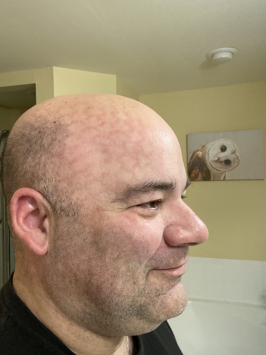 kmitchell74's tweet photo. I do brag about my @Purple harmony pillow and how well I sleep. I didn’t realize I sleep so hard that I wake up with the grid pattern across my face. Even the owl in the background is looking at me like “what tha…?” #HardSleeper https://t.co/49HULkpg4x