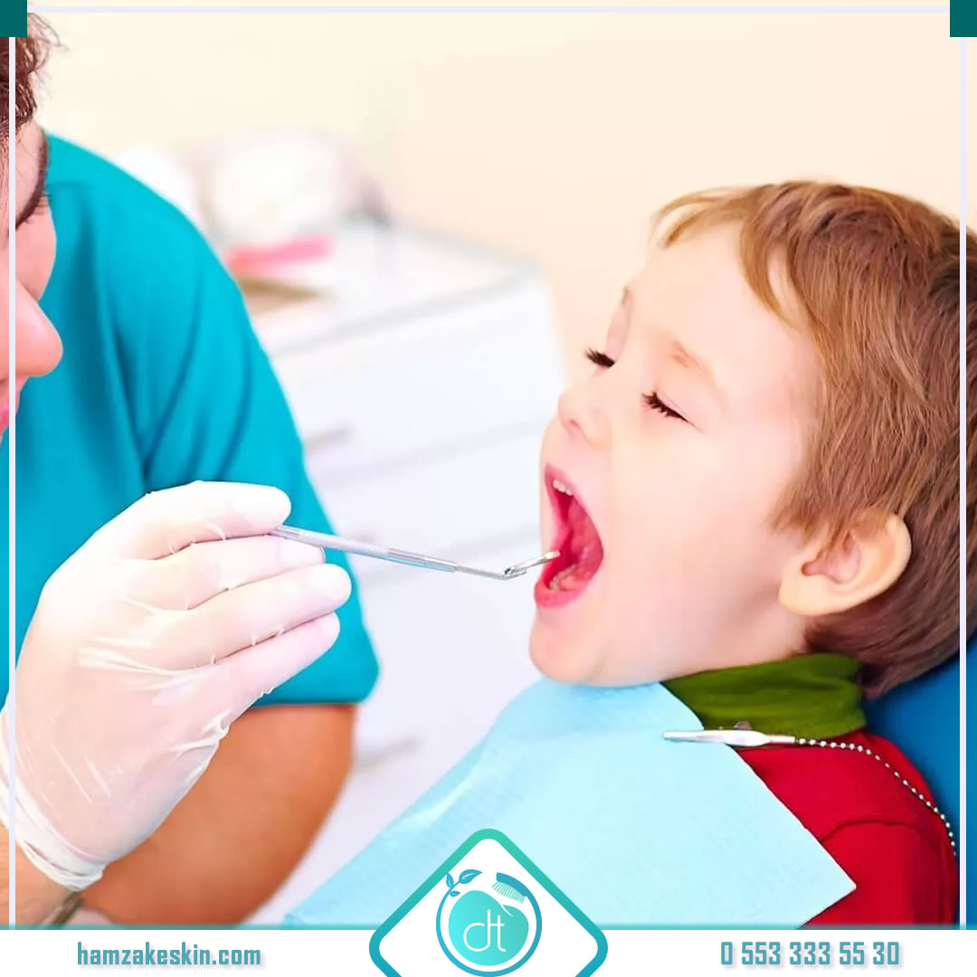 💫 Fissür örtücü nedir? Azı dişlerindeki oluk ve çatlakları kapatıp buralardaki besin birikimini engelleyerek oluşabilecek çürüklerin önüne geçen koruyucu bir tedavi yöntemi. 
💫 Fissür Örtücü Nedir? 👉 bit.ly/2PMf33R
#fissür #dişaşısı #dolgu #çocukdiş #pedodonti