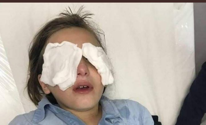 Marchfoward's tweet photo. 4 kanak kanak mengalami luka melecur di muka apabila disembur dengan lada oleh seorang penduduk haram Z10nis di Kejiranan Sheikh Jarrah, Baitul Maqdis https://t.co/MNXc69ORJ9