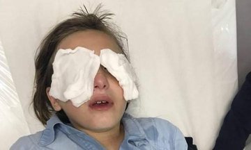 🇵🇸 Astaghfirullah ... 4 gadis kecil menderita luka bakar di wajahnya akibat seorang Yahudi menyemprotkan gas merica pada wajah mereka, di lingkungan Sheikh Jarrah. 💔😭😭
Semoga lekas sembuh adik-adikku.🤲
Hasbunallaahu wa ni'mal wakiil.

#SaveSheikhJarrahh
#FreePalestine ❤🇵🇸