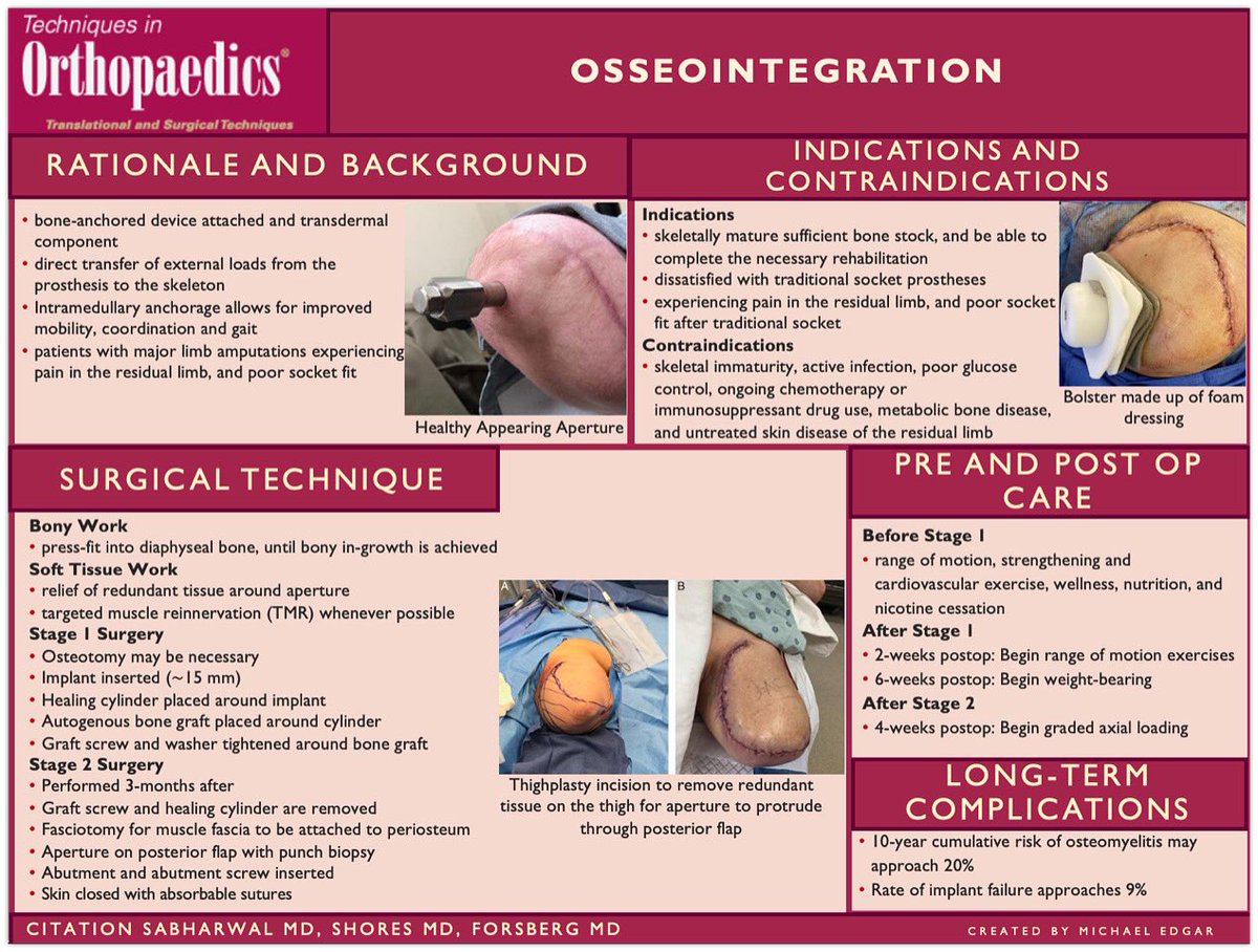 Our latest #VisualAbstract in out! "Osseointegration."

#Orthopedics #orthotwitter #orthopaedics #orthopedicsurgery
