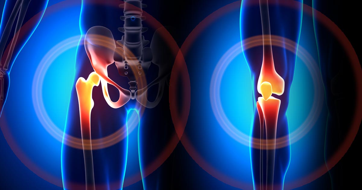 Study examines factors affecting knee confidence trajectories in patients with knee OA: healio.com/news/orthopedi…