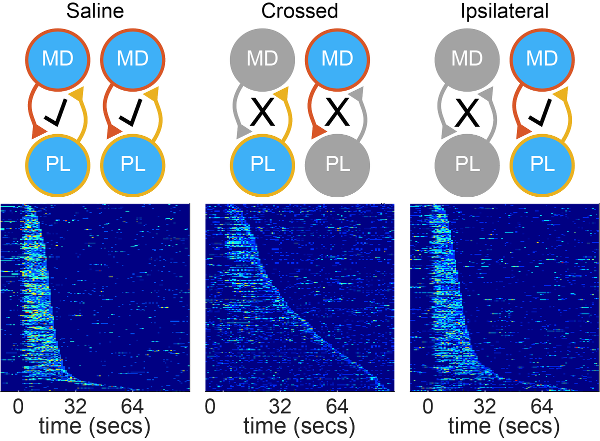 Iowa Neuroscience Institute (@uiowaneuro) on Twitter photo New preprint from <a href="/ParkerLab/">Tony Parker</a> expands understanding of brain networks that support timing & suggests mediodorsal thalamus-prelimbic cortex interactions are a core component biorxiv.org/content/10.110β¦ New preprint from <a href="/ParkerLab/">Tony Parker</a> expands understanding of brain networks that support timing & suggests mediodorsal thalamus-prelimbic cortex interactions are a core component biorxiv.org/content/10.110β¦