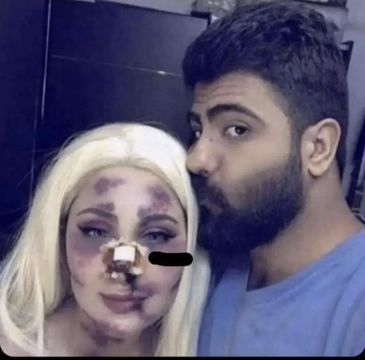 ‏﮼فـيصل ﮼الشيباني ᷂ tweet media