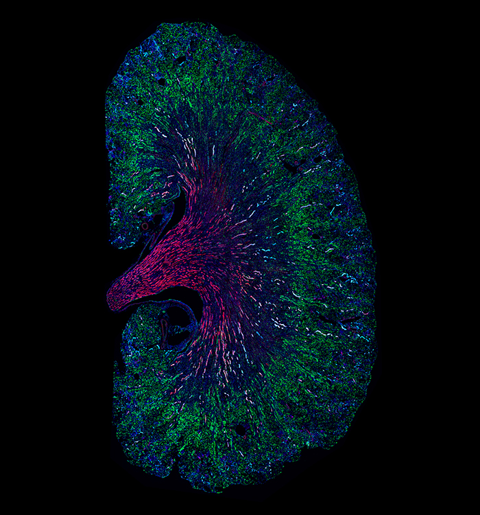 USC Stem Cell (@uscstemcell) on Twitter photo The <a href="/USCStemCell/">USC Stem Cell</a> lab of Andy McMahon has identified a type of injured cell that might contribute to the transition from an acute kidney injury to chronic kidney disease, as described in a new study in PNAS. <a href="/PNASnews/">PNASNews</a> <a href="/KeckSchool_USC/">Keck School of Medicine of USC</a> stemcell.keck.usc.edu/acute-kidney-i… The <a href="/USCStemCell/">USC Stem Cell</a> lab of Andy McMahon has identified a type of injured cell that might contribute to the transition from an acute kidney injury to chronic kidney disease, as described in a new study in PNAS. <a href="/PNASnews/">PNASNews</a> <a href="/KeckSchool_USC/">Keck School of Medicine of USC</a> stemcell.keck.usc.edu/acute-kidney-i…