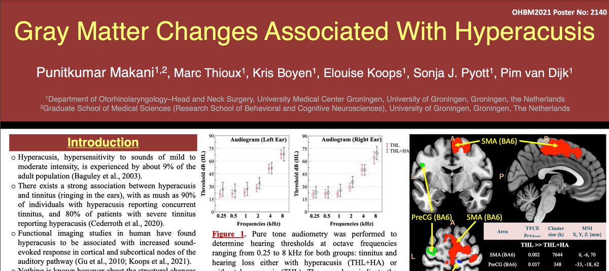 Check out this OHBM Poster, Gray Matter Changes Associated with Hyperacusis at ohbm.sparkle.space/in/poster2140