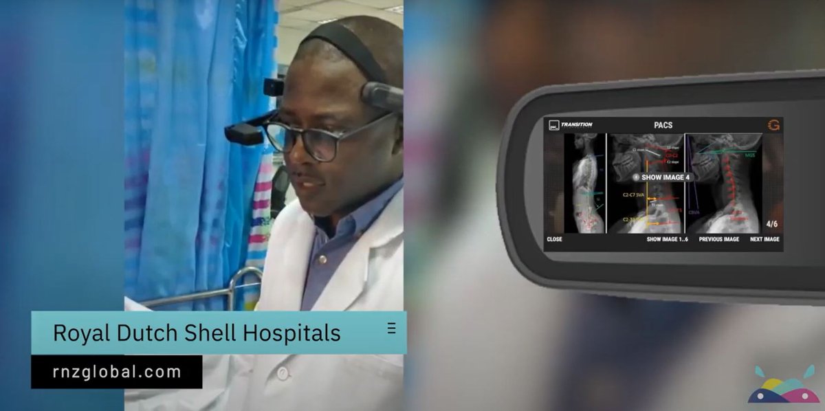 "There was one story, Port Harcourt, <a href="/RNZGlobal/">RNZ Global</a> Hospital, a patient going to surgery wanted to try our headset first... At that moment, I saw the future of #HippoVirtualCare–the power, availability &amp; the clinician-patient connection." #lifechanging

ow.ly/rWee50FfjYl