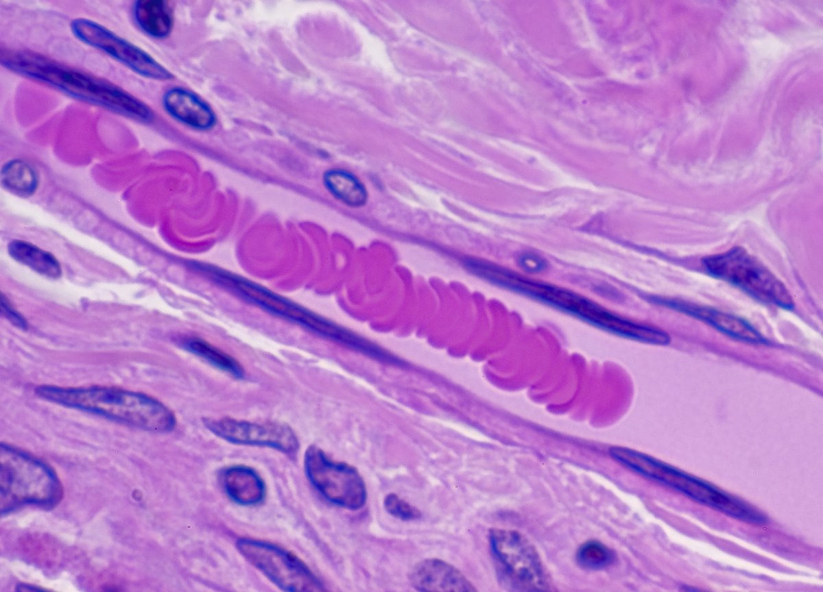 GENbio's tweet photo. Scientists have discovered a link between a protein in red blood cells and age-related decline in cognitive performance. Depleting ADORA2B results in quick decline in memory, delayed auditory processing, and increased inflammation in the brain. Learn more: https://t.co/iNvbsDIOfn https://t.co/E25t2NDWE4