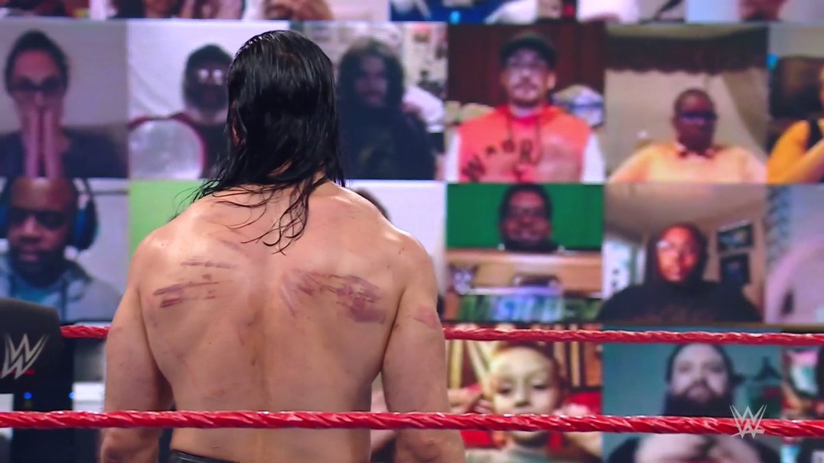 Battle wounds.

#WWERaw