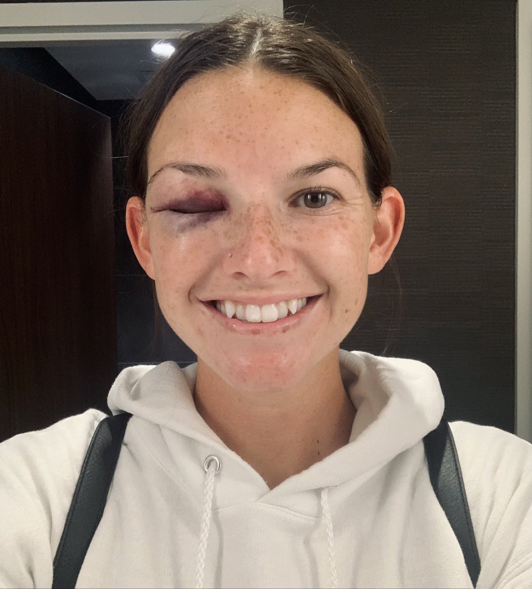 I sure do love my job! Thanks for all the love and support sent my way!! Cant wait for my eye to open so I can get back on the field😅