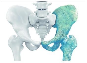 Hope after hip fracture with new registry toolbox launch
Read more buff.ly/3gzwcIU

#hipfractures #AsiaPacific #APACregion #alarmingrate #death #disability