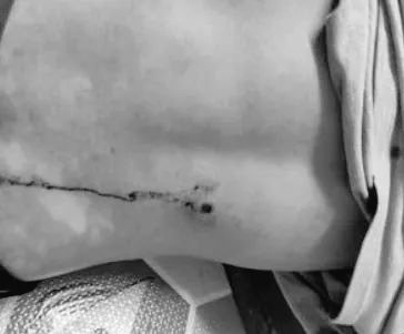 Byun_Sori6104's tweet photo. Tw // Blood // Gunshot 

Two youths from Mandalay got shot in the back and hand by Junta Terrorists while delivering the sacks of rice. 

#June22Coup #WhatsHappeningInMyanmar https://t.co/UKX4wk86FD