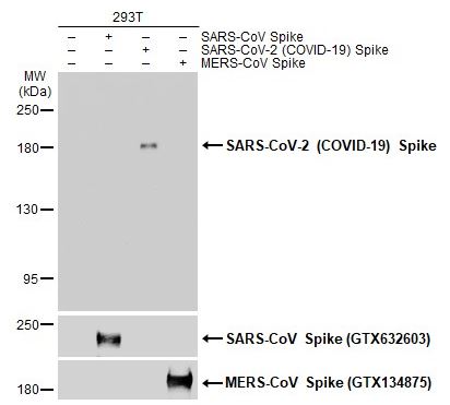 genetexinc's tweet photo. Congratulations to Steenblock and colleagues who published their work in Nature Communications using GeneTex’s Spike antibody! 👉https://t.co/bQLpEKQJdY
“Viral infiltration of pancreatic islets in patients with #COVID19”
#risk #ACE2 #TMPRSS2 #virusentry #pancrease #SARSCoV2 https://t.co/57lb9wNdXH