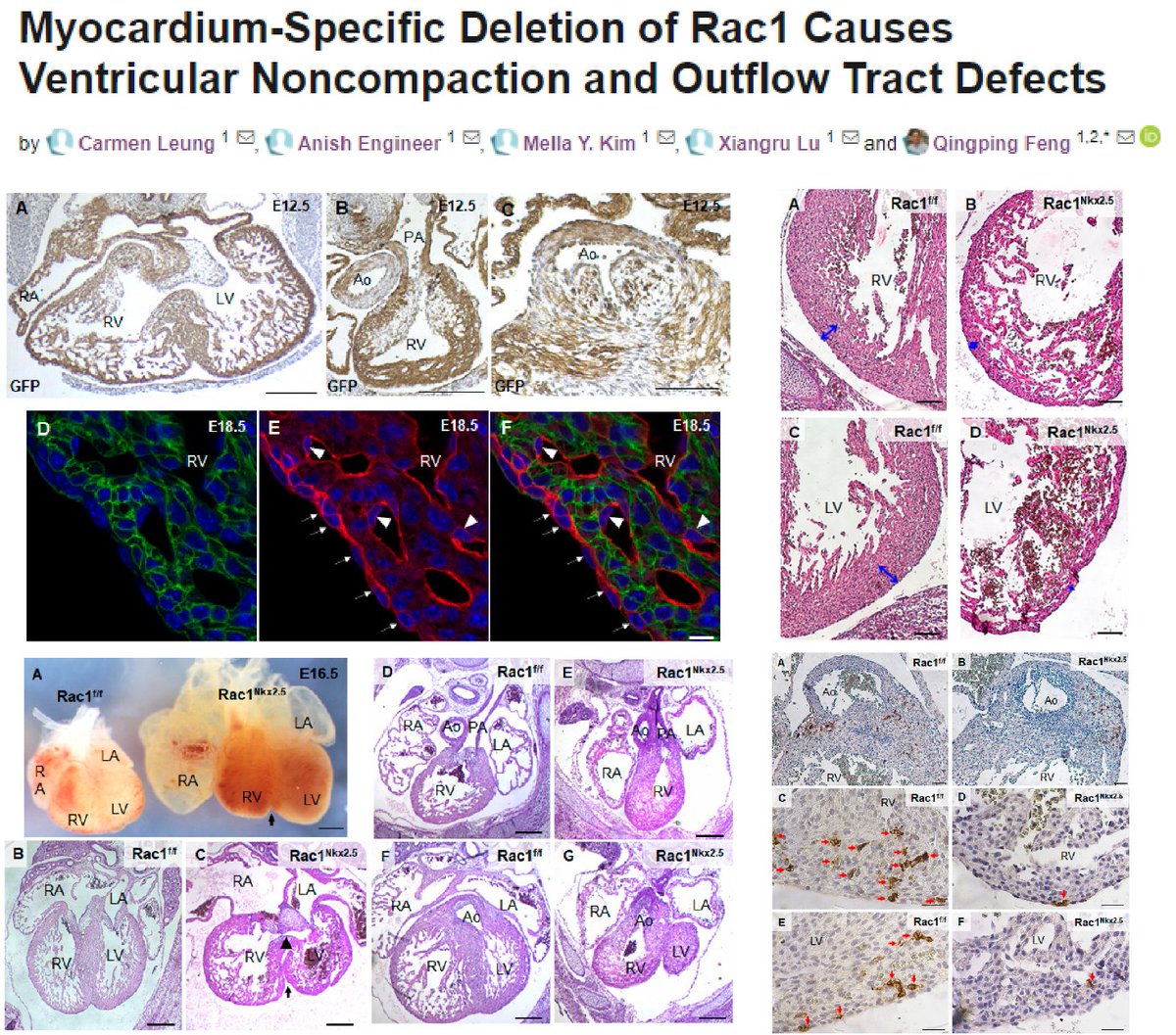 HaoYin20's tweet image. Cardiomyocyte (Nkx2.5-Cre) Rac1 KO causes🐭congenital heart defects with⏬Scribb (#PlanarCellPolarity protein) abundance &amp;amp; compromised cardiomyocte organization/proliferation

Dr. Qingping Feng lab @JCDD_MDPI 2021 @QFeng3 @SchulichMedDent @westernuPandP
mdpi.com/2308-3425/8/3/…