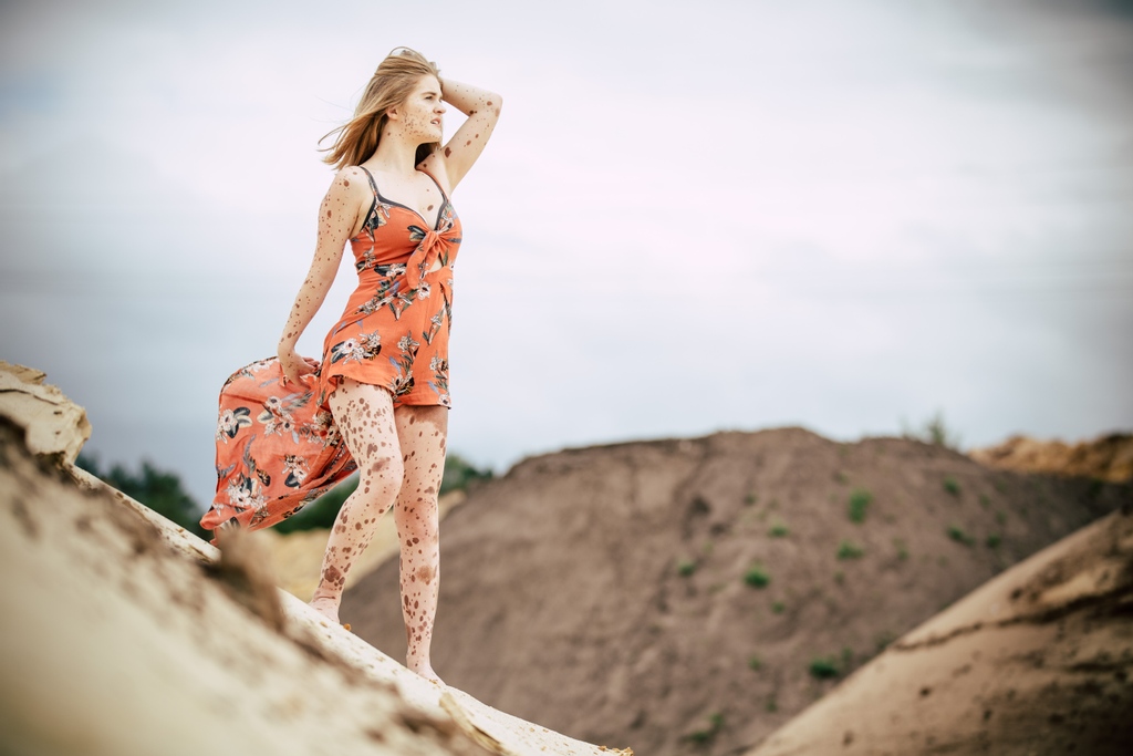 fmp_bremen's tweet photo. OLD but GOLD
Marika_Shooting
____________________________
M: @marynevus
P: @frozen_moment_photografie
____________________________ 
#frozen_moment_photografie #fmp 
#bremen #niedersachsen #blumenthal

#Outfit 
#Girl 
#bareyourbirthmark https://t.co/6f1yf240P6