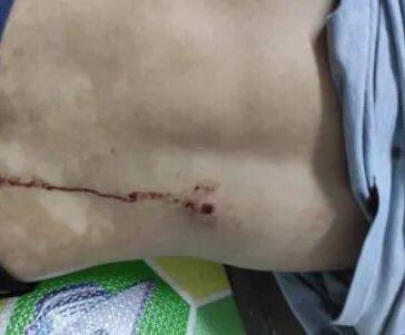 Shin02669747's tweet photo. tw // blood Junta terrorists recklessly opened gunfires near 54x111 st, Mandalay and injured a passerby carrying rice bag jn the back and arm. Other casualties are also reported. #UnfetteredAccessForAids #June22Coup  #WhatsHappeningInMyanmar https://t.co/SqK9RQ92cC https://t.co/tjKtdw0qF9