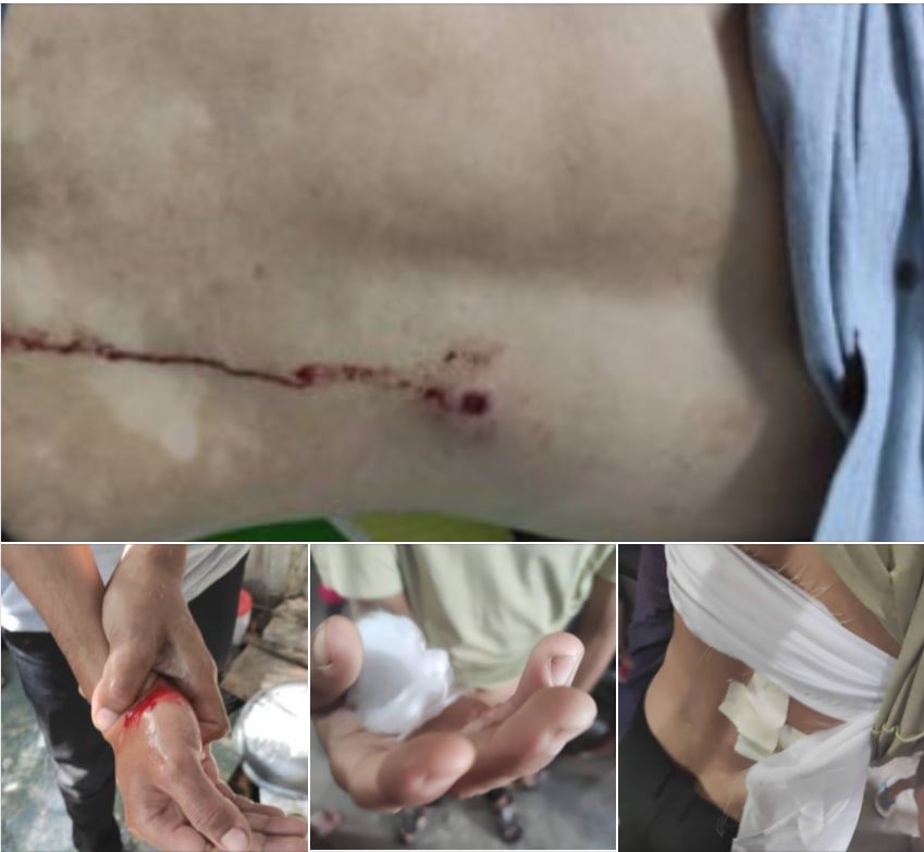 HTUN TONE MYO THIT, Mandalay:

Two young men delivering rice bags were SHOT by SAC Terrorists at 53th Street today morning. One of them INJURED in the back and hand. 

#June22Coup #WhatsHappeningInMyanmar #MilkTeaAlliance