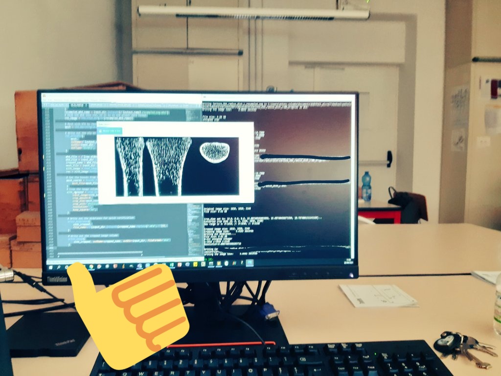 BABYPACE_MSCA's tweet photo. I swear, it's biological anthropology 😅 #bonemicroarchitecture https://t.co/KwsWHGZAwW