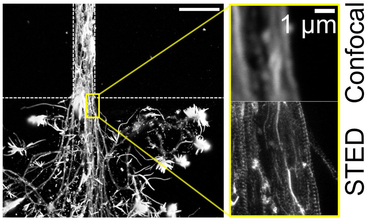 Now updated with STED data of axon diameter within microchannel patterns!

#axon #microfluidics