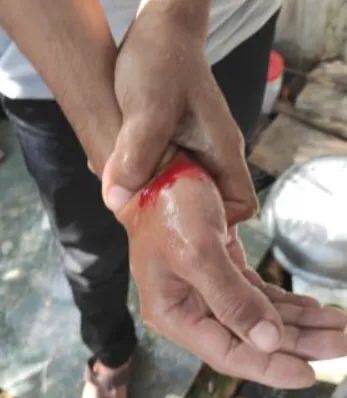 YyKana1's tweet photo. tw // blood
Junta terrorists recklessly opened gunfires near 54x111 st, Mandalay and injured a passerby carrying rice bag jn the back and arm. Other casualties are also reported.
#UnfetteredAccessForAids
#June22Coup 
#WhatsHappeningInMyanmar https://t.co/VJusV5haID https://t.co/nzmvJV0j7y