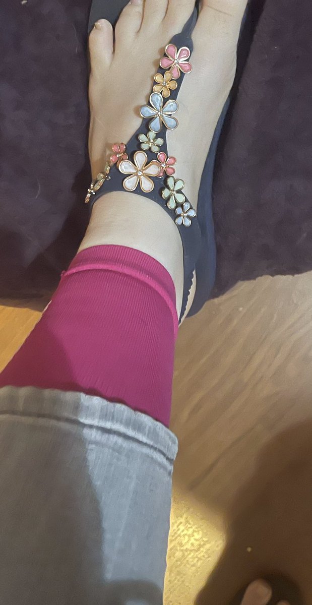 DawnKovalcik's tweet image. Haha! Found a way to still wear my sandals while recovering. Compression sleeves!! #saphenousvein #legrecovery #veins
