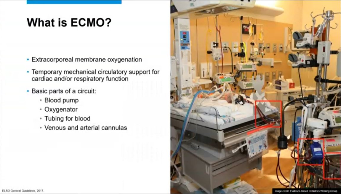 What Is ECMO?
