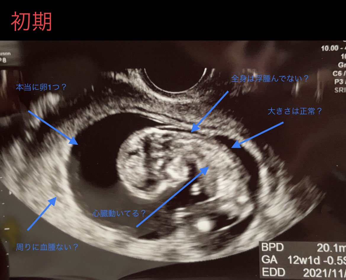 ままになる@4y&1yの産婦人科医 tweet media