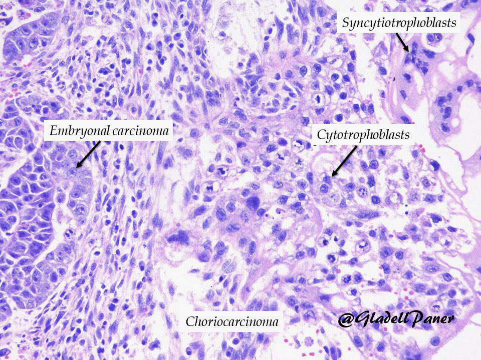 Embryonal Carcinoma Cells