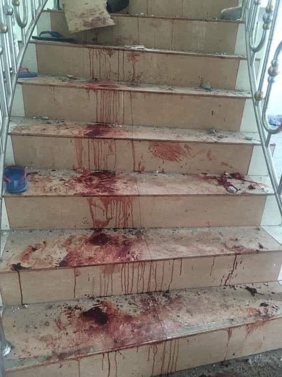 hana_thitsar's tweet photo. After the situation of terror SAC raided the dormitory of Mandalay PDF; 2 ppl from PDF have been killed and 6 were abducted. tw // blood

#UnfetteredAccessForAids
#WhatsHappeningInMyanmar
#June22Coup https://t.co/WZkJY2J2Hl