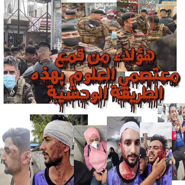 AlmayahiKarrar8's tweet photo. اكثر شريحة اتعرضت للضرب و الاعتداء و نزف الدماء هم خريجو العلوم... اين الانصاف من ٢٧٠٠٠ درجة وظيفية الى ١٤٠٠٠ درجة وظيفية و الان فقط بس ٧٠٠٠ درجة وظيفية اين الانصاف
@Mu_AlSadr @MOHealth_Iraq @lkteffaalhasnaw @jwadalmosswi @MAKadhimi @IraqiPMO 
#اين_درجات_العلوم_يالصحه https://t.co/DuaJGZzn3l