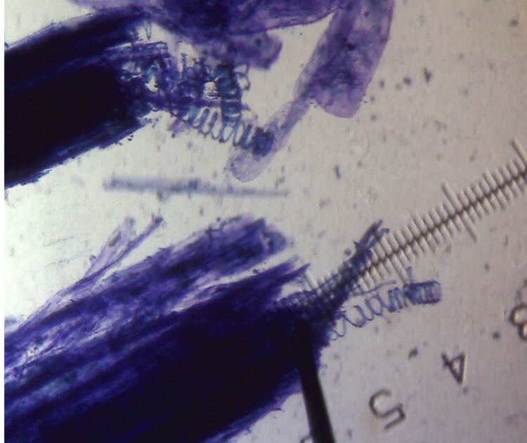 aegilopoides's tweet image. A big thank you to whoever it was who suggested using tinned rhubarb to look at the lignin spirals in xylem. This was the first attempt. #chatbiology