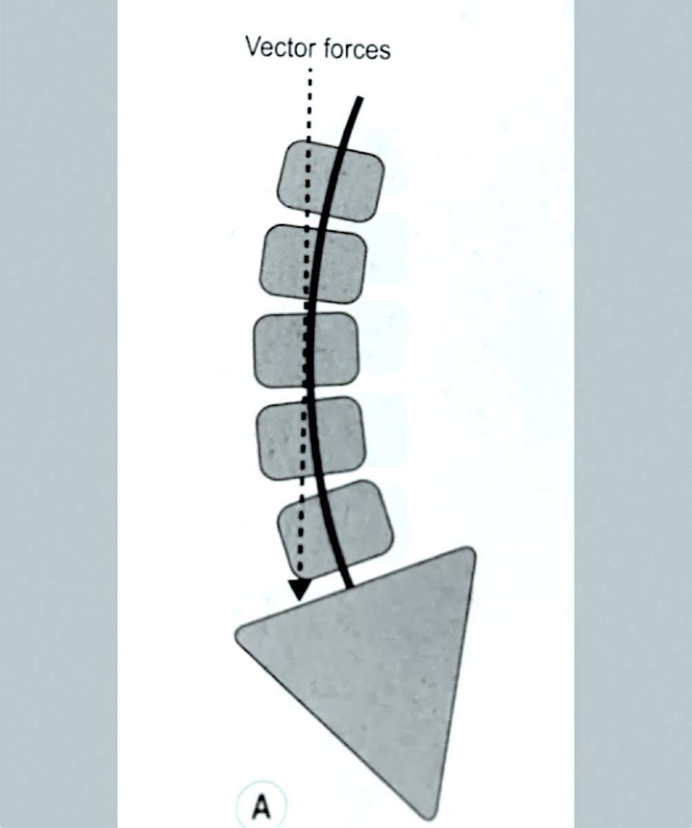 A force vector is when the force has a particular direction or point of application and magnitude. In movement, your body weight, and forces from outside the body like ground forces are forces moving through the body creating movement. facebook.com/MadelineBlackM…