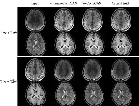 Our W-CycleGAN #deeplearning model presented at #OHBM2021 is capable of synthesizing unacquired or corrupted #MRI image contrast using available #MRI image contrasts. <a href="/CincyKidsRad/">Cincy Kids Radiology</a> <a href="/AI_CAD_CCHMC/">Lili He</a> <a href="/DrNehalParikh/">Nehal Parikh, DO, MS</a> <a href="/therealjonadill/">Jonathan Dillman</a> <a href="/AndrewTroutMD/">Andrew Trout</a> <a href="/StephanieMerhar/">Stephanie Merhar</a> <a href="/HailongLi_OH/">Hailong Li</a>