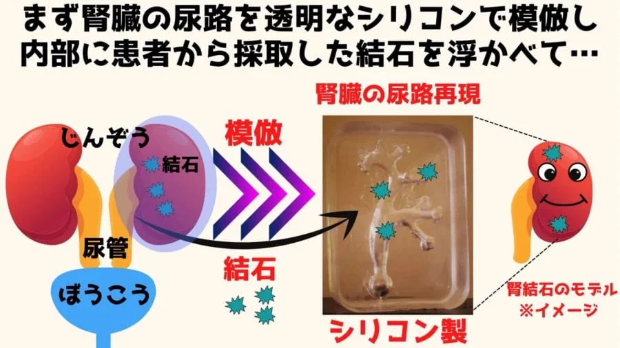 驚きの検証結果！？ビッグサンダーマウンテンに腎臓結石を排出させる効果がある！