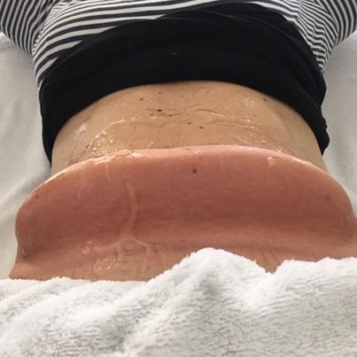 damowanggg's tweet photo. #Weight loss (cooling plus)
#sumouning #surgery #attractingfat #skintightening 
#organism #metabolism #moisture #Reparing #striae #gravidarum;
#muscies,#musclespasm #alleviatingmuscles;
#Losingweight 
Certificate:CE
☎️whatsapp:0086 15503022871 https://t.co/0ybZ4qR4Iz