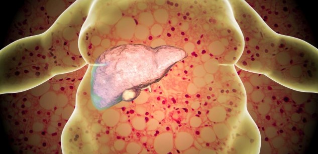 UDRH_VIC's tweet photo. The #liver may be one of the less well recognised issues among metabolic disorders. Our #researchers found the % of non-alcoholic fatty liver disease #NAFLD in #rural communities was 36%. Greater awareness may assist with early detection and treatment.

🔗 https://t.co/htbt1cTBqq https://t.co/3aYwDxkyPz