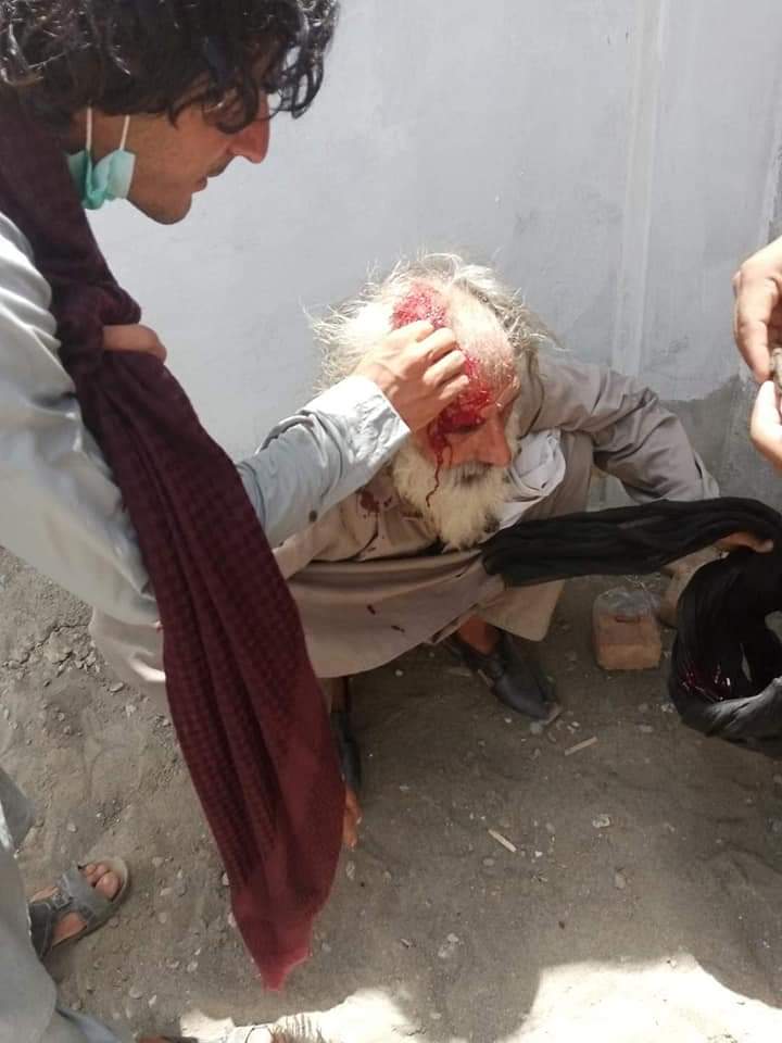 MahkomAfghan's tweet photo. I am amazed by the criminal silence of mainstream media particularly our well known brave outspoken journalists like @HamidMirPAK, @SaleemKhanSafi,@javeednusrat, @Matiullahjan919 @asmashirazi on #JanikhelPeaceMarch2Islamabad where police are killing peaceful protestors https://t.co/OtS2ZFvZYn