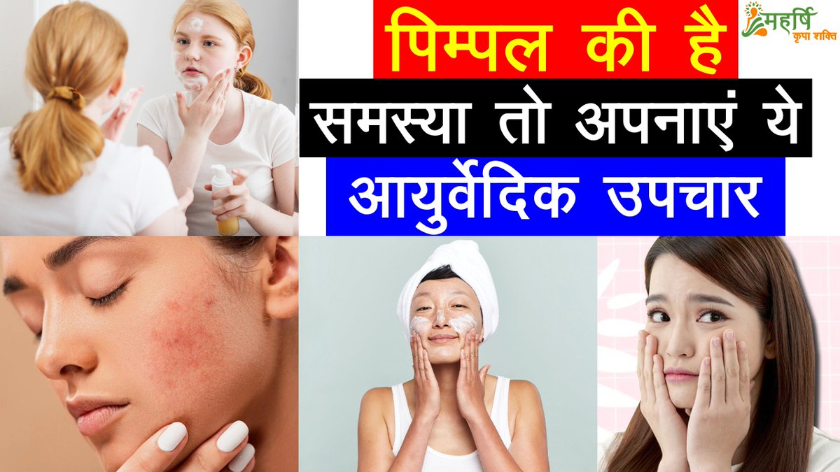 kripashakti1's tweet image. पिम्पल्स की है समस्या तो अपनाएं ये आयुर्वेदिक टिप्स | Kripa Shakti Ayurveda | Health

#UltimateAyurvedicofPimples, #PimplesRemoval, #PimplesHomemadeTreatment, #PimplesSolution, #PimplesKaiseHataye, #acne, #pimple, #skincare,

For More Details: bit.ly/3xJ8fET