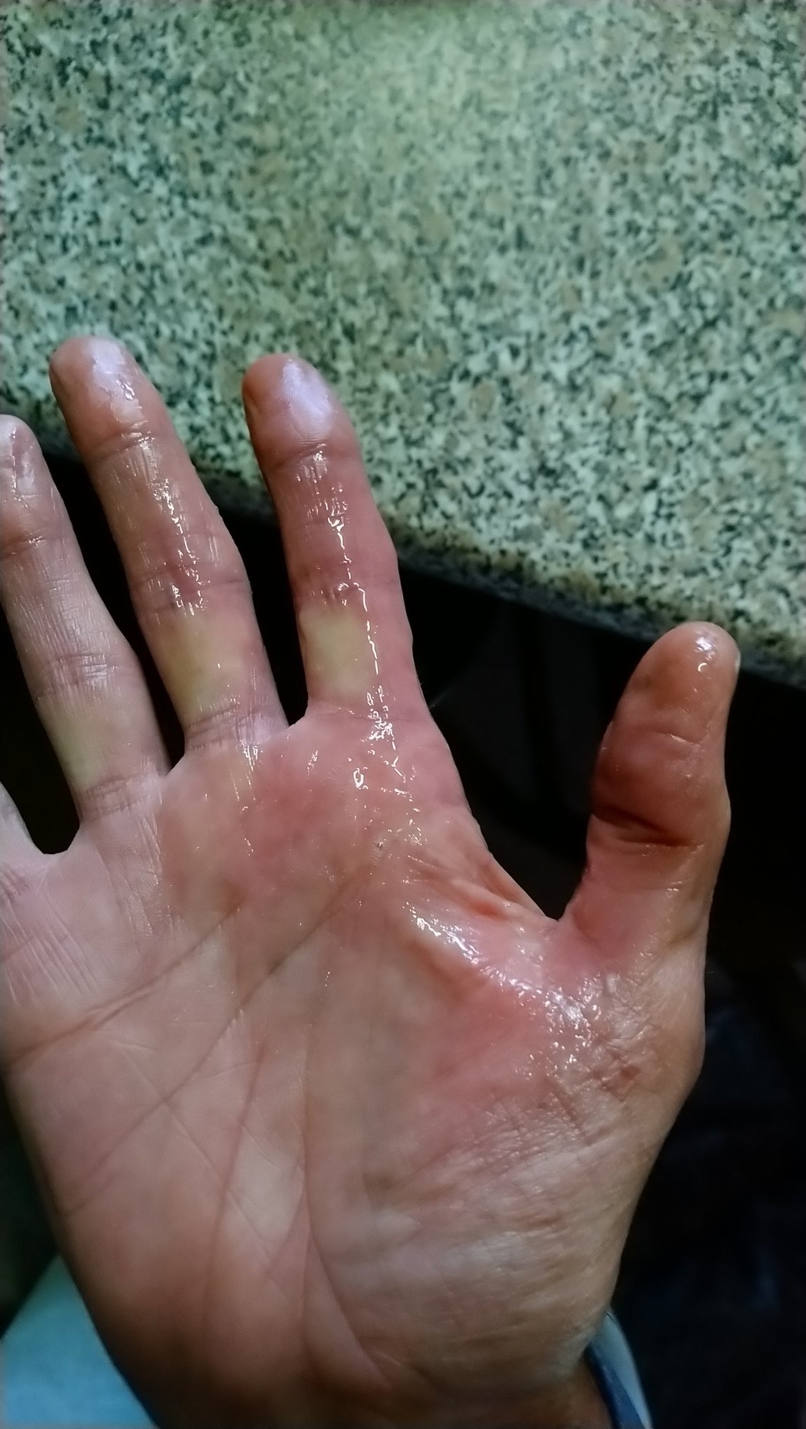 precum   / X