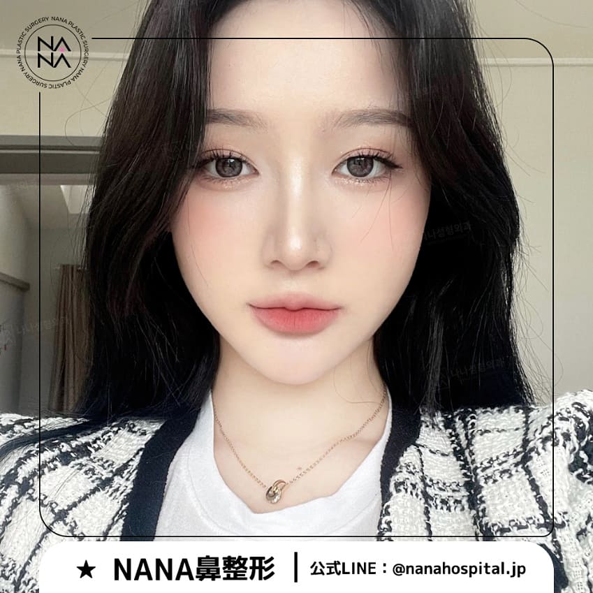 韓国整形nana美容外科 Nanahospital Twitter 韓国整形nana美容外科 Nanahospital Twitter