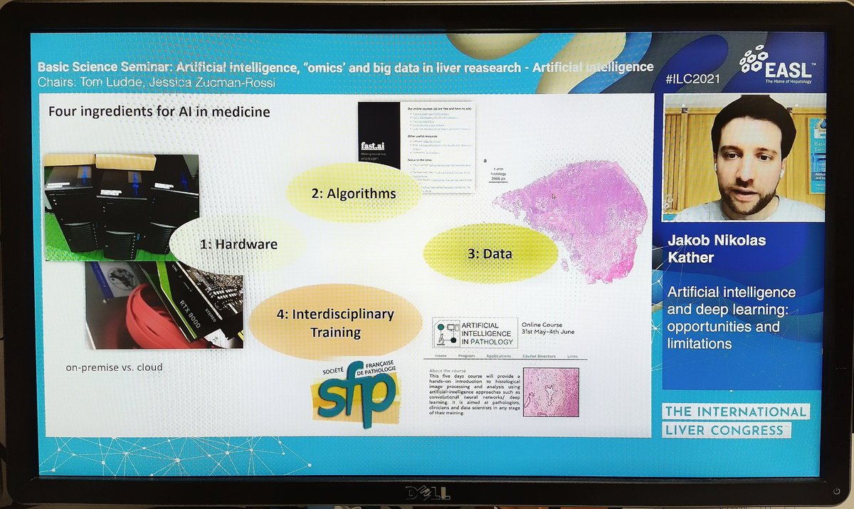 Standardisation/harmonisation of laboratory protocols will be essential for the creation of universal, accurate and precise #MachineLearning models for #PredictiveMedicine and #ComputationalMedicine

#ILC2021 #AI #BigData #BasicScience #LiverTwitter @EASLedu @EASLnews