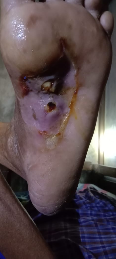 Ada ga rekomendasi obat, buat penyakit gula,  orang tua saya... Sedih melihatnya.. Semoga ada yang kasih info obatnya.. Terimakasih