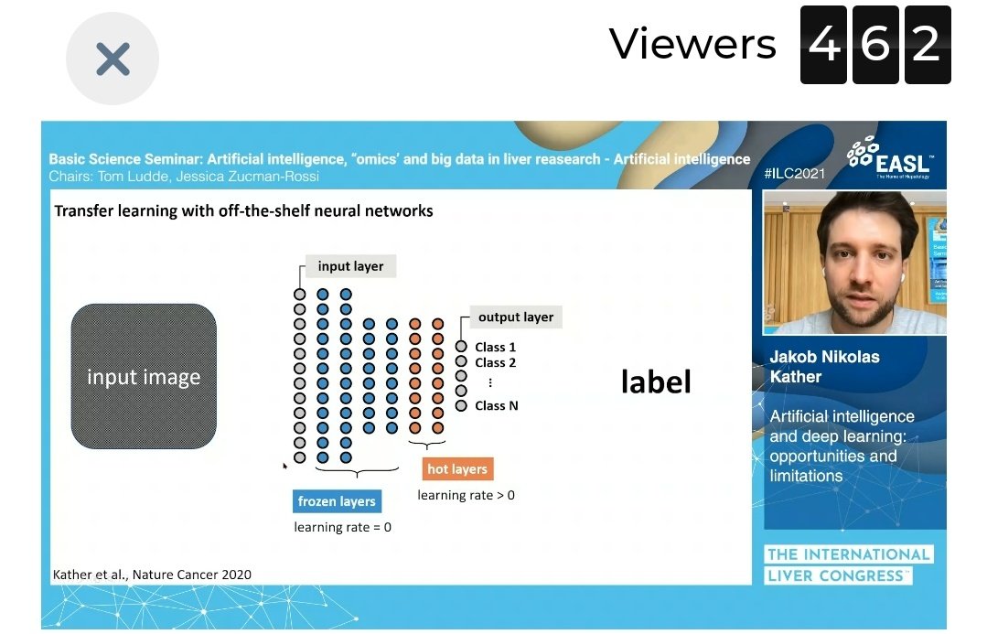 Amazing presentation  on #ILC2021 about #BigData artificial intelligence #BasicScience
#LiverTwitter @EASLedu @EASLne
What is essential and challenging? Unification? Standardisation? Harmonisation of Health systems around Europe?@EUHealthUnion  @EU_Health @WHO_Europe @EuropeLiver