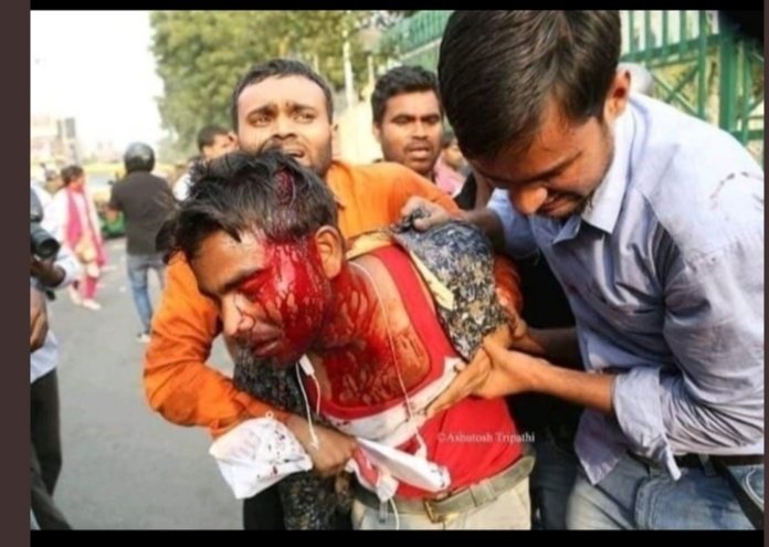 #बीएडटीईटी2011_को इच्छा मृत्यु दो।     या 
हमें नियुक्ति देकर हमारे साथ न्याय करो
माननीय योगीजी अपना वायदा पूरा करो
योगीजी नियुक्ति दो या जीवन से मुक्ति दो
<a href="/blsanthosh/">B L Santhosh</a> <a href="/myogiadityanath/">Yogi Adityanath</a> <a href="/rashtrapatibhvn/">President of India</a> <a href="/kpmaurya1/">Keshav Prasad Maurya</a> <a href="/drdineshbjp/">Dr Dinesh Sharma BJP</a> <a href="/AmitShah/">Amit Shah</a> <a href="/ndtv/">NDTV</a> <a href="/UPGovt/">Government of UP</a>