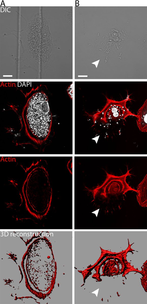 Thrilled to announce that our work describing T. cruzi egress from host cell is now published online at mBio! journals.asm.org/doi/10.1128/mB…
<a href="/KevinMTyler/">Kevin Tyler</a> <a href="/BonfimMeloA/">Alexis Bonfim-Melo, PhD</a> @BBurleighChagas <a href="/JCostalesC/">JaimeCostalesC</a>